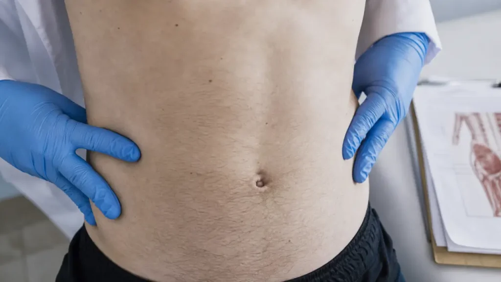 Cretes iliaques : repère L4, palpation des douleurs