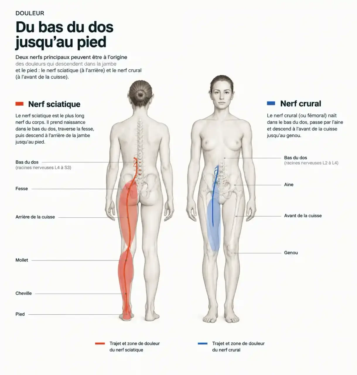 Schéma du trajet de la douleur de la hanche jusqu'au pied : nerf sciatique à l'arrière et nerf crural à l'avant de la jambe